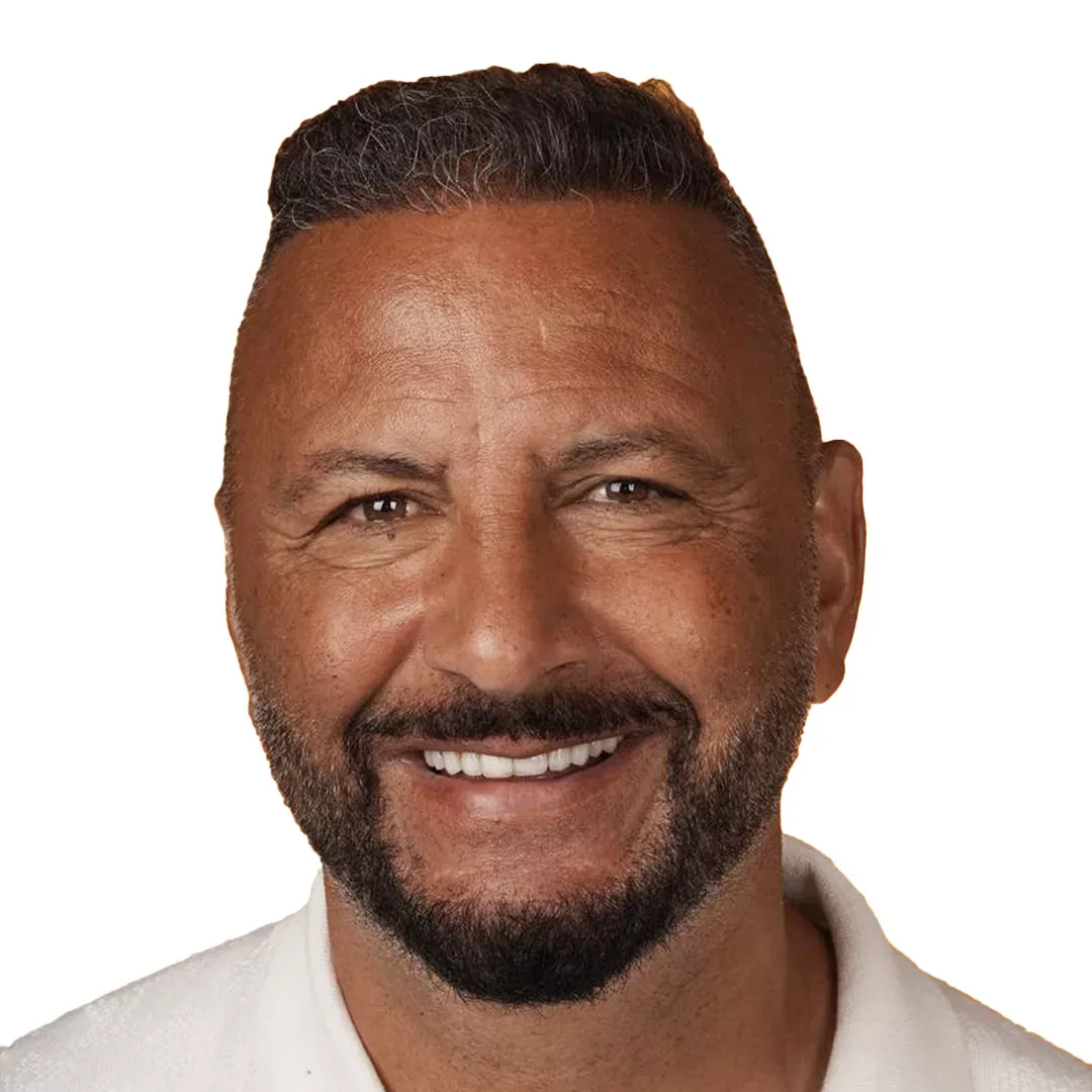 Hair Transplant — After