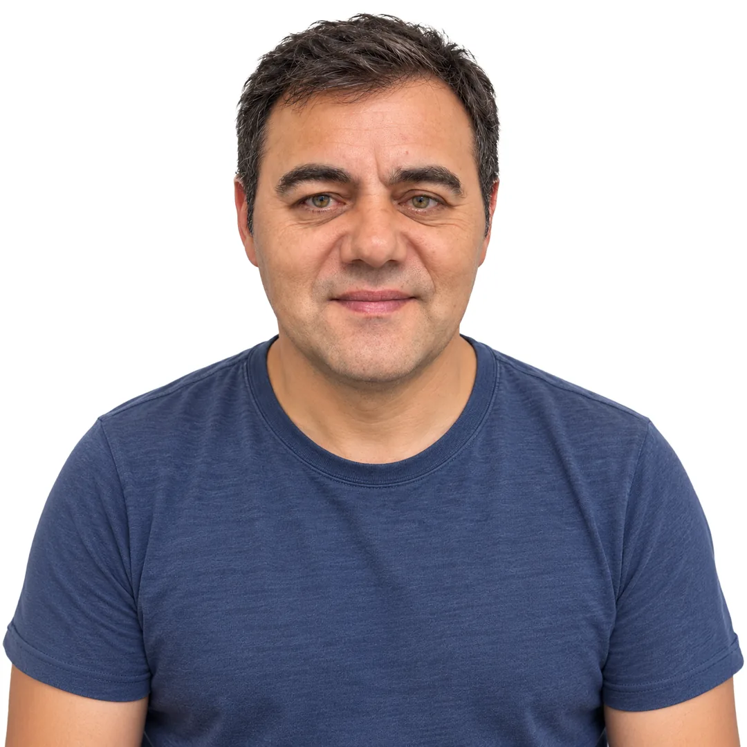 Hair Transplant · Front — After