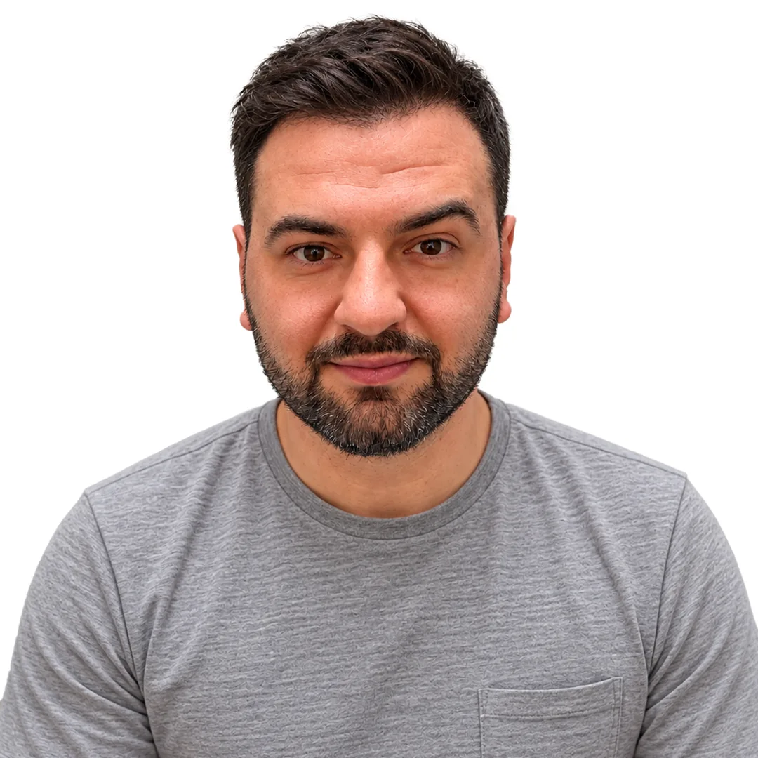 Hair Transplant · Front — After