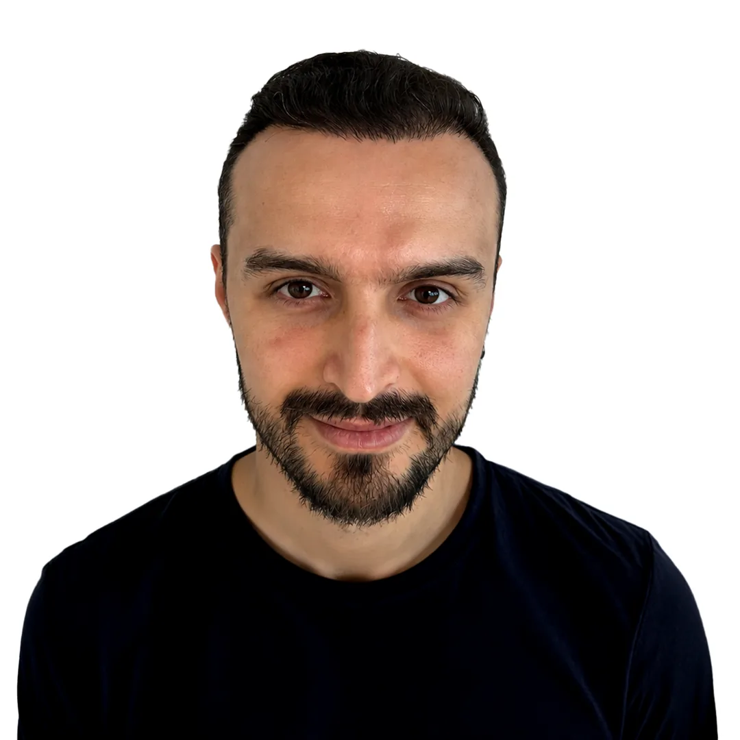 Hair Transplant · Front — After