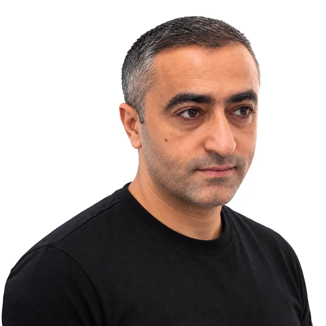 Hair Transplant · Three-quarter — After