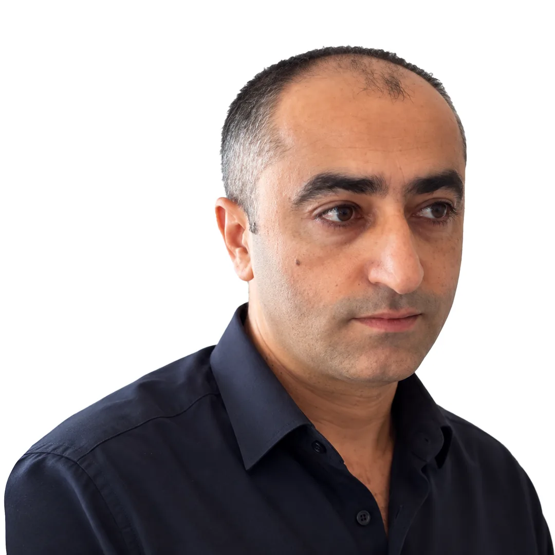 Hair Transplant · Three-quarter — Before