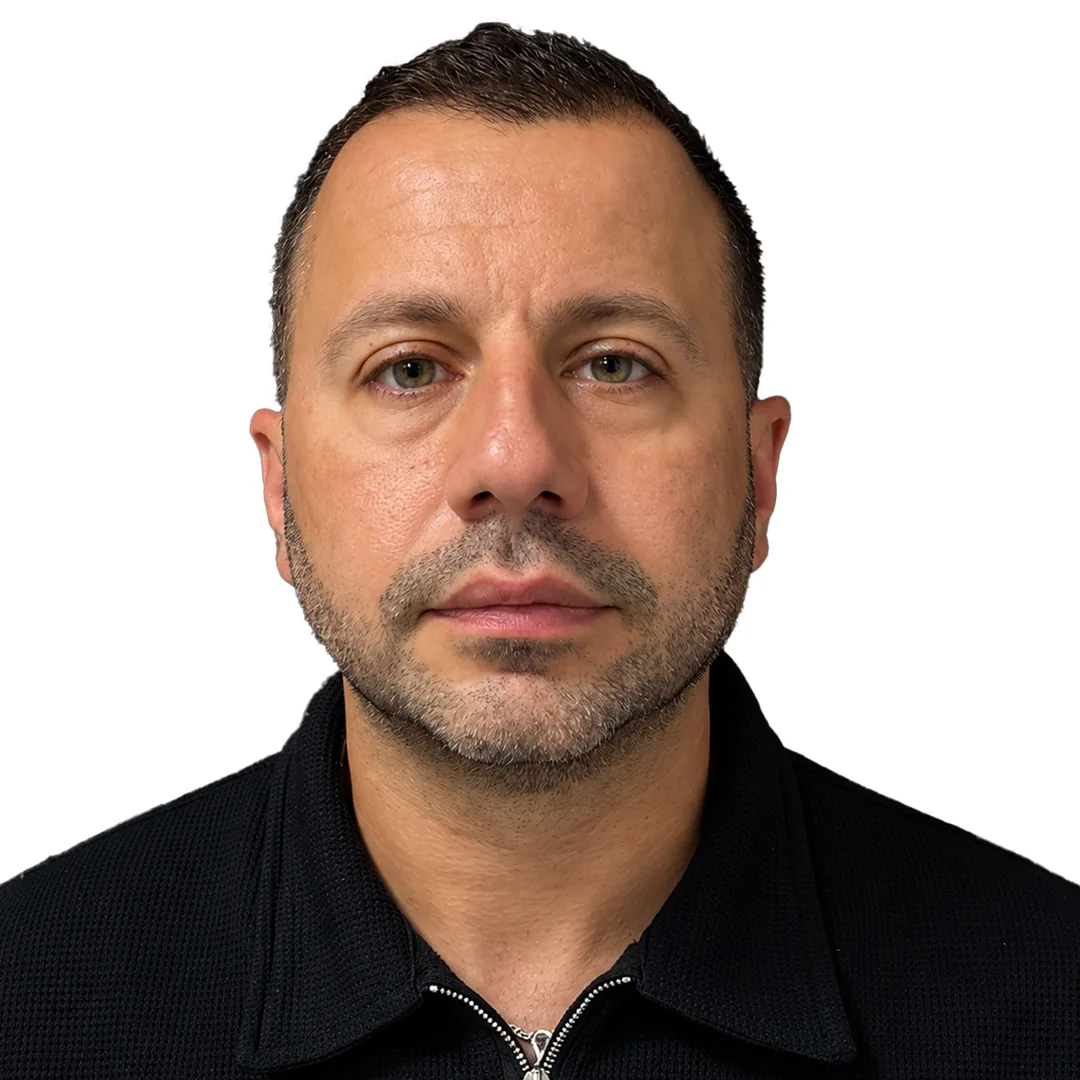 Rhinoplasty · Front — До