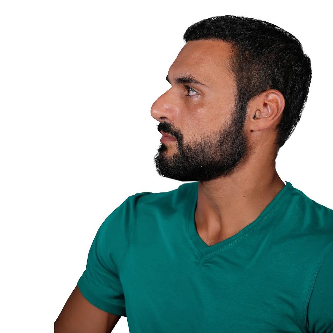 Rhinoplasty · Three-quarter — До