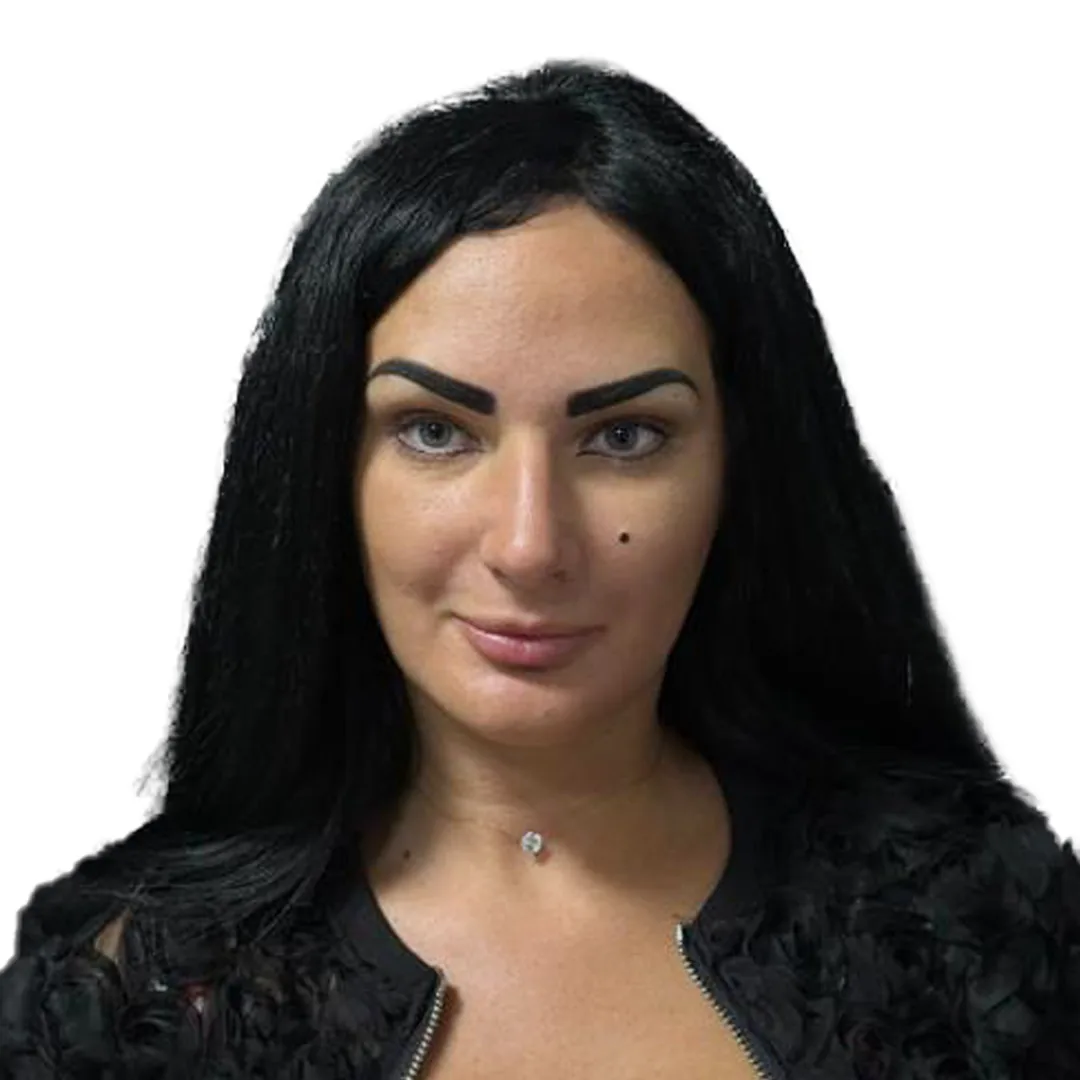Rhinoplasty · Front — До