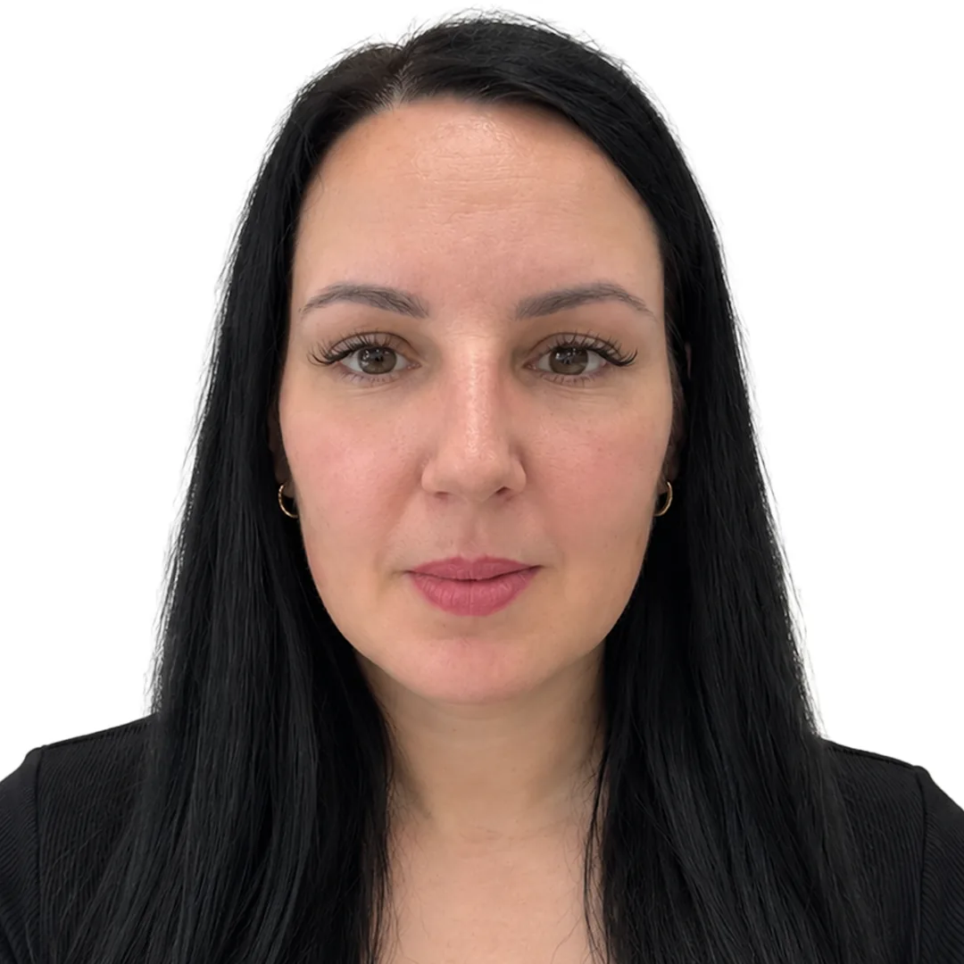 Rhinoplasty · Front — Після