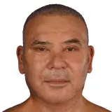 Face & Neck Lift
