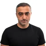 Hair Transplant · Front