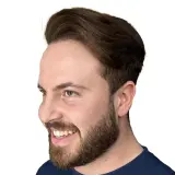 Hair Transplant
