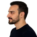 Hair Transplant · Profile