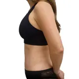 Liposuction · Side