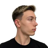 Rhinoplasty · Profile