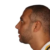 Rhinoplasty