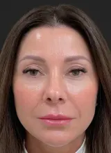 Skin · Hydration