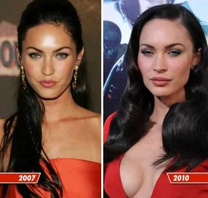megan fox after breast implant surgery 2010
