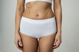 belly surgery