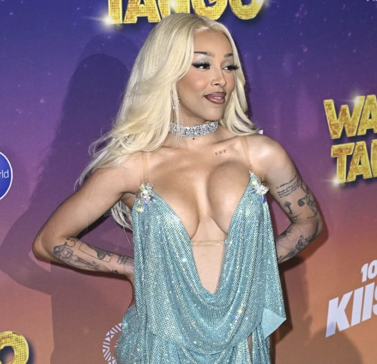 doja cat după intervenție