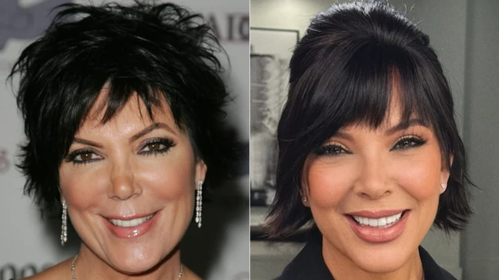 Kris Jenners Neues Gesicht Ihre Kosmetischen Behandlungen LIN