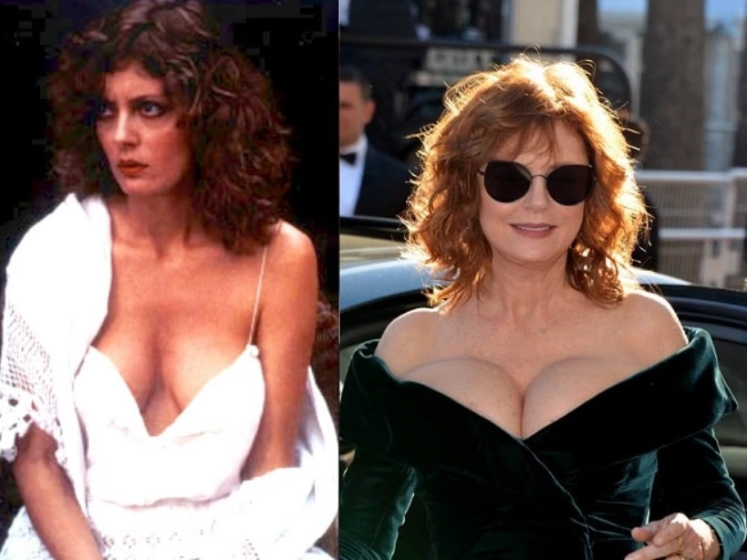 susan sarandon prima e dopo