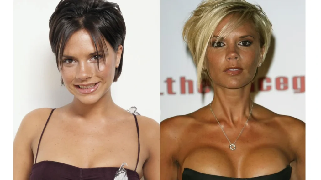 victoria beckham before after cover