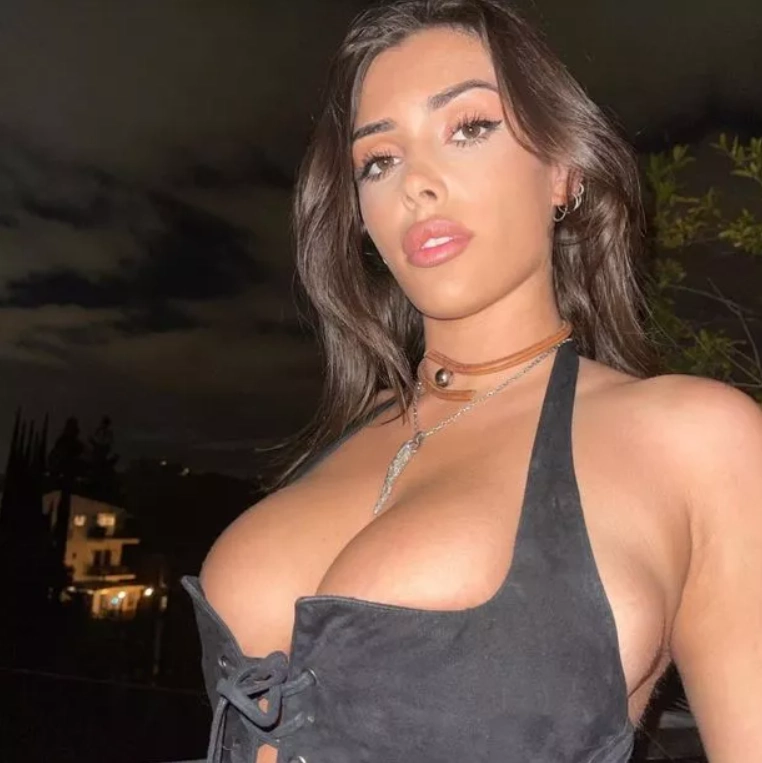 bianca before the surgery