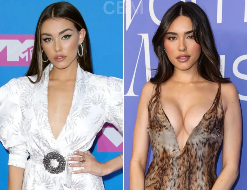 madison prima e dopo