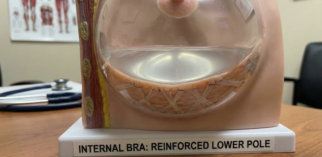 modello anatomico dettaglio di reggiseno interno con polo inferiore rinforzato