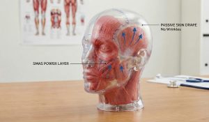 anatomical model illustrating deep plane facelift layers