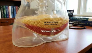 anatomical model subcutaneous belly fat