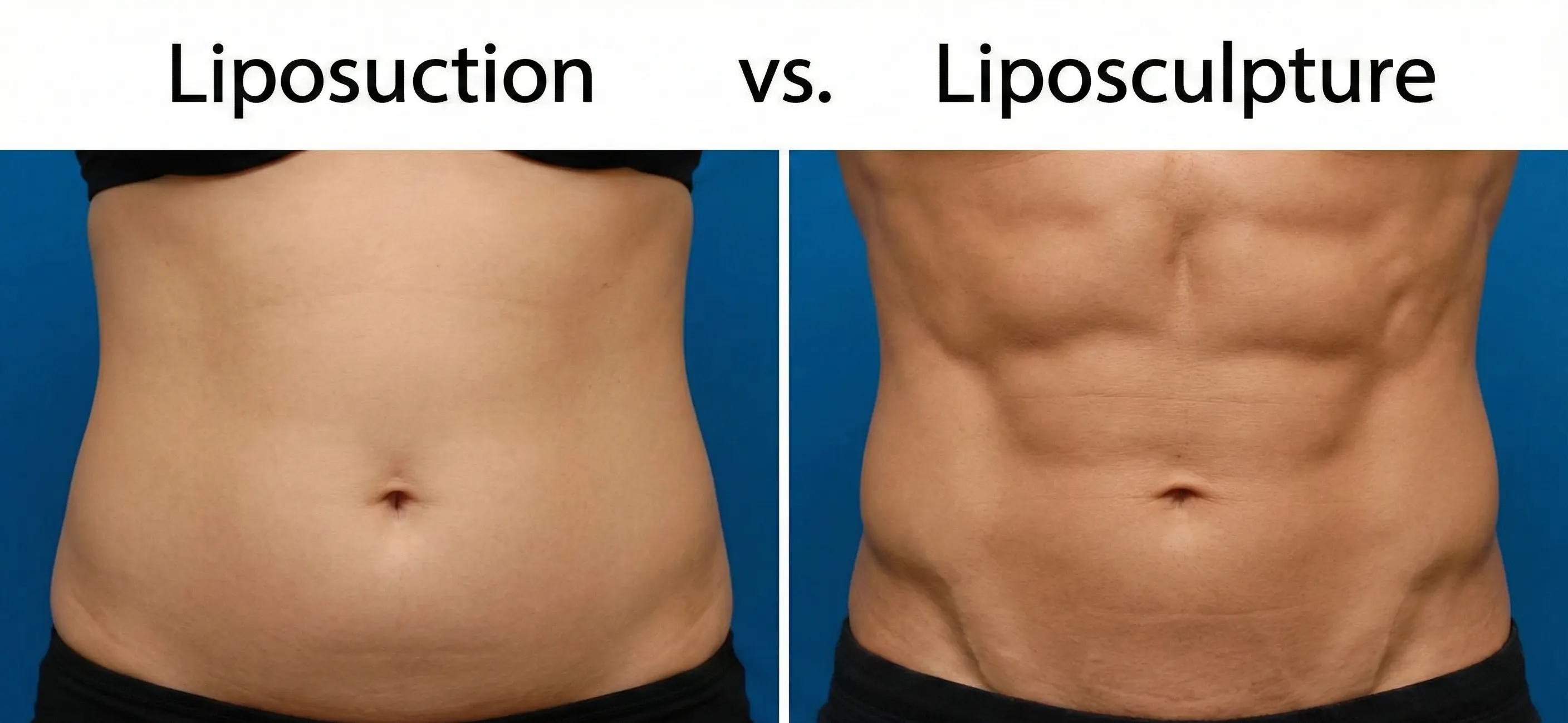confronto tra risultato di liposuzione e liposculpture adding modello piatto vs addome scolpito