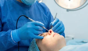 open rhinoplasty columellar incision surgical photo