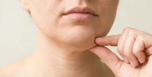 person pinching double chin fat pocket