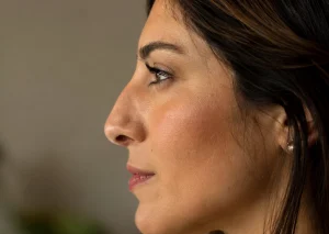 woman side profile nose bridge hump